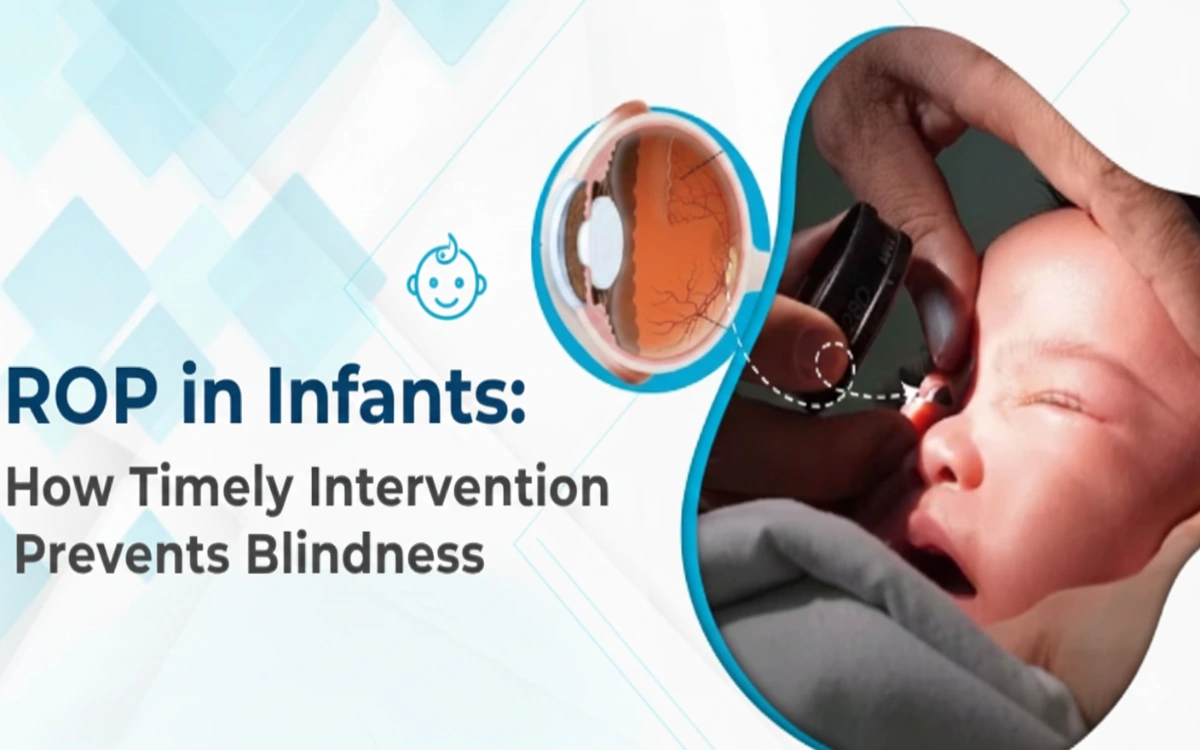 Premature babies are at risk of ROP, a leading cause of childhood blindness. Learn how early eye checks and prompt treatment can save your infant’s sight.