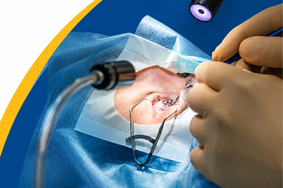 Cataract surgery with intraocular lens implantation